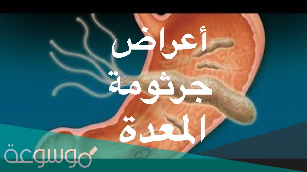 ما أعراض جرثومة المعدة بالتفصيل