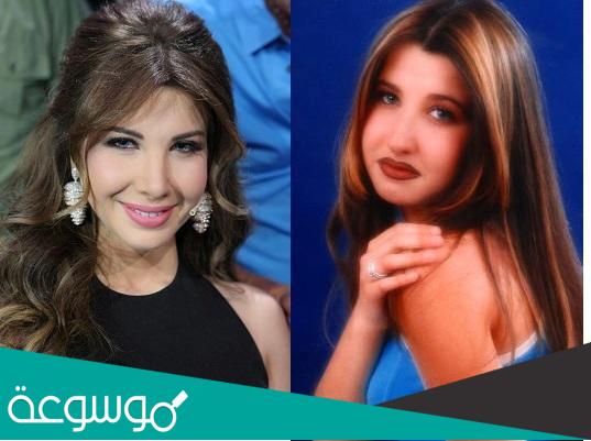 نانسي عجرم قبل وبعد عمليات التجميل